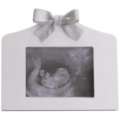 Prénatal Echo Fotolijstje Wit