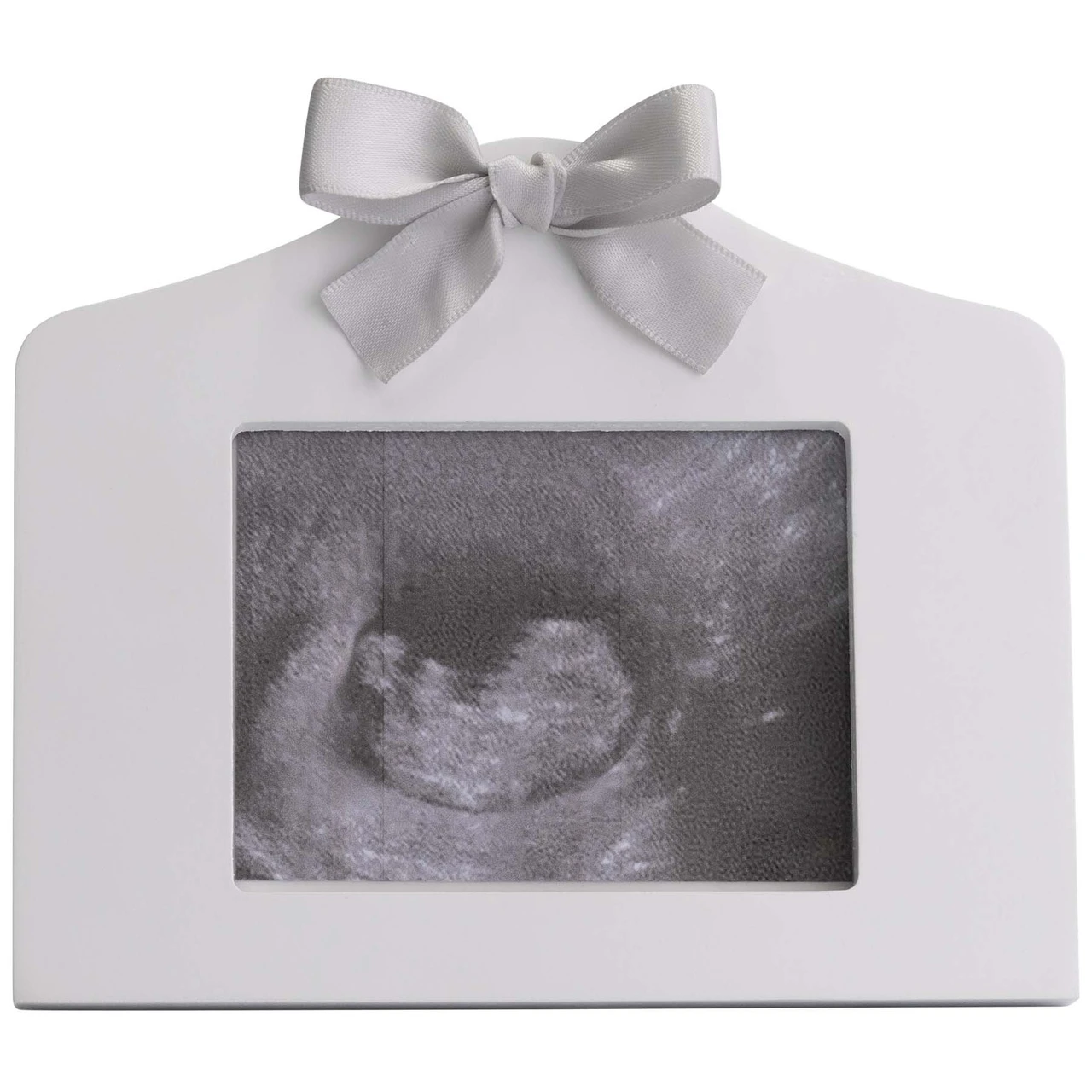 Prénatal Echo Fotolijstje Wit 1 Prénatal Echo Fotolijstje Wit