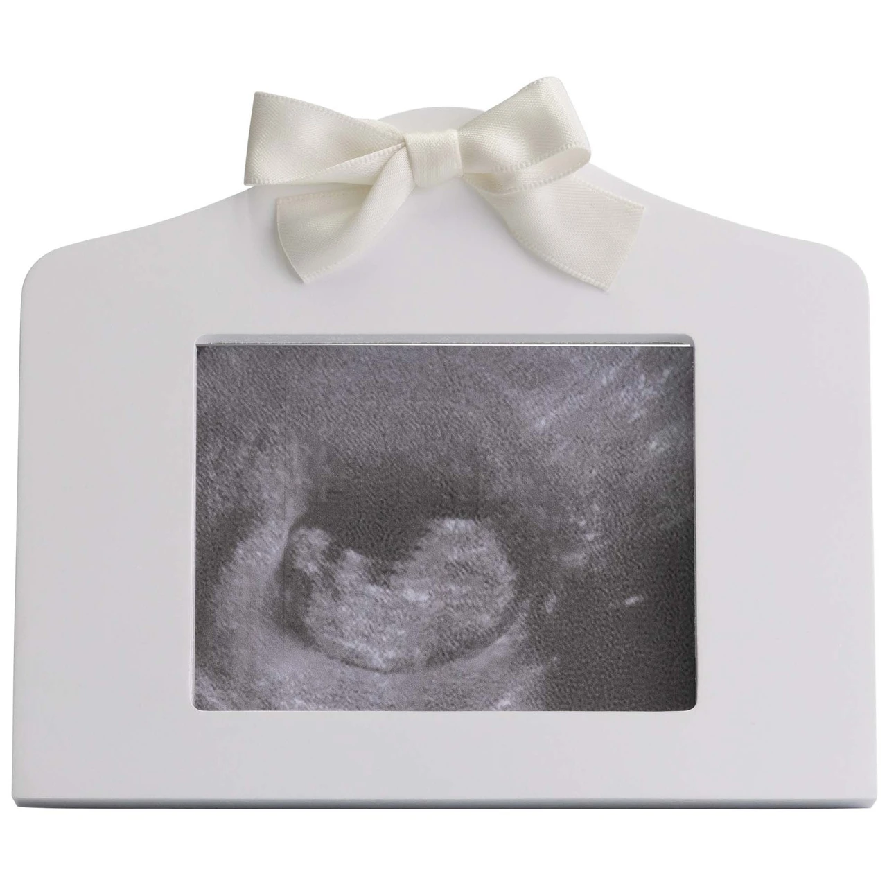 Prénatal Echo Fotolijstje Wit 2 Prénatal Echo Fotolijstje Wit - Afbeelding 2