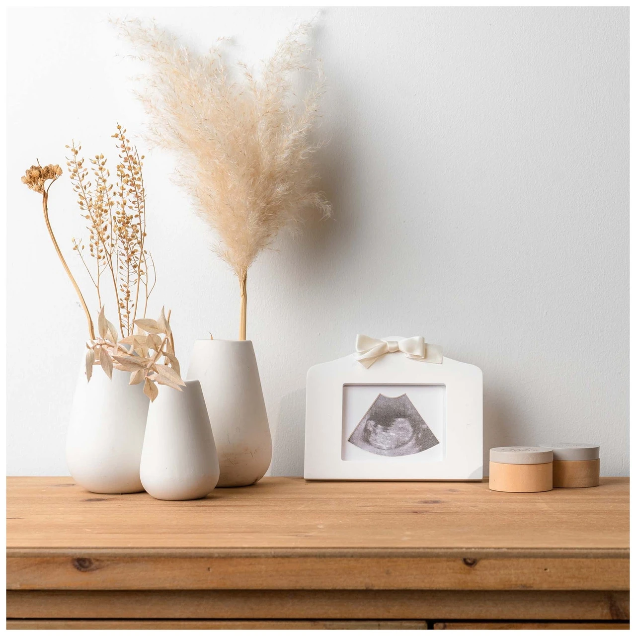 Prénatal Echo Fotolijstje Wit 5 Prénatal Echo Fotolijstje Wit - Afbeelding 5