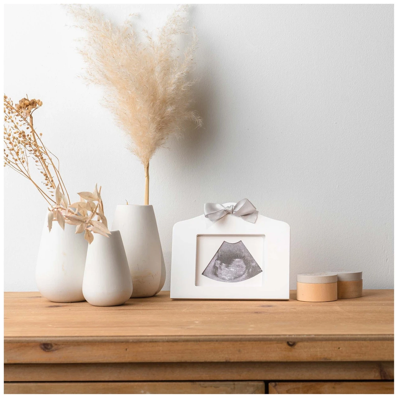 Prénatal Echo Fotolijstje Wit 6 Prénatal Echo Fotolijstje Wit - Afbeelding 6